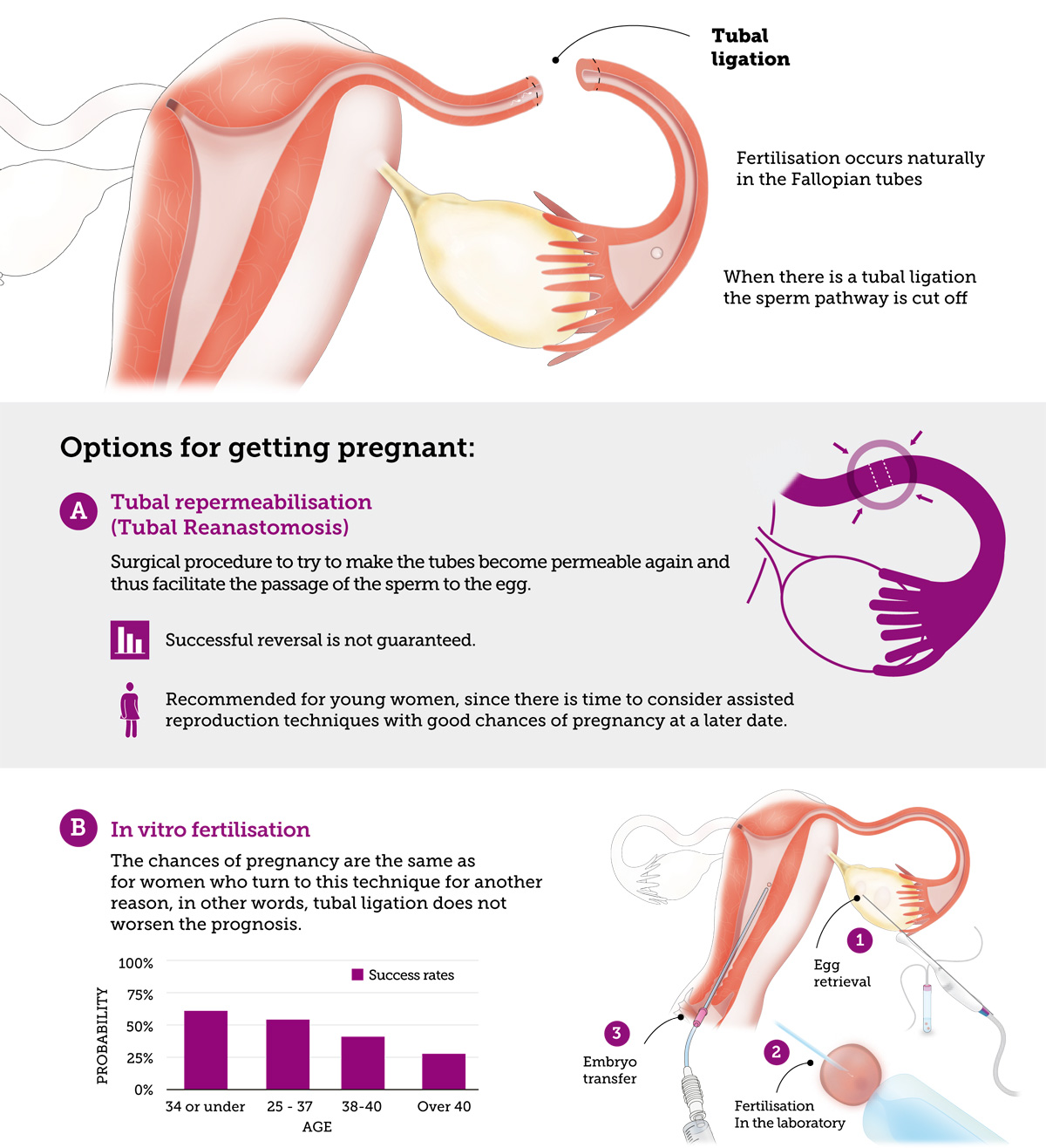 Can I Get Pregnant After Tubal Ligation Eugin IVF Clinic